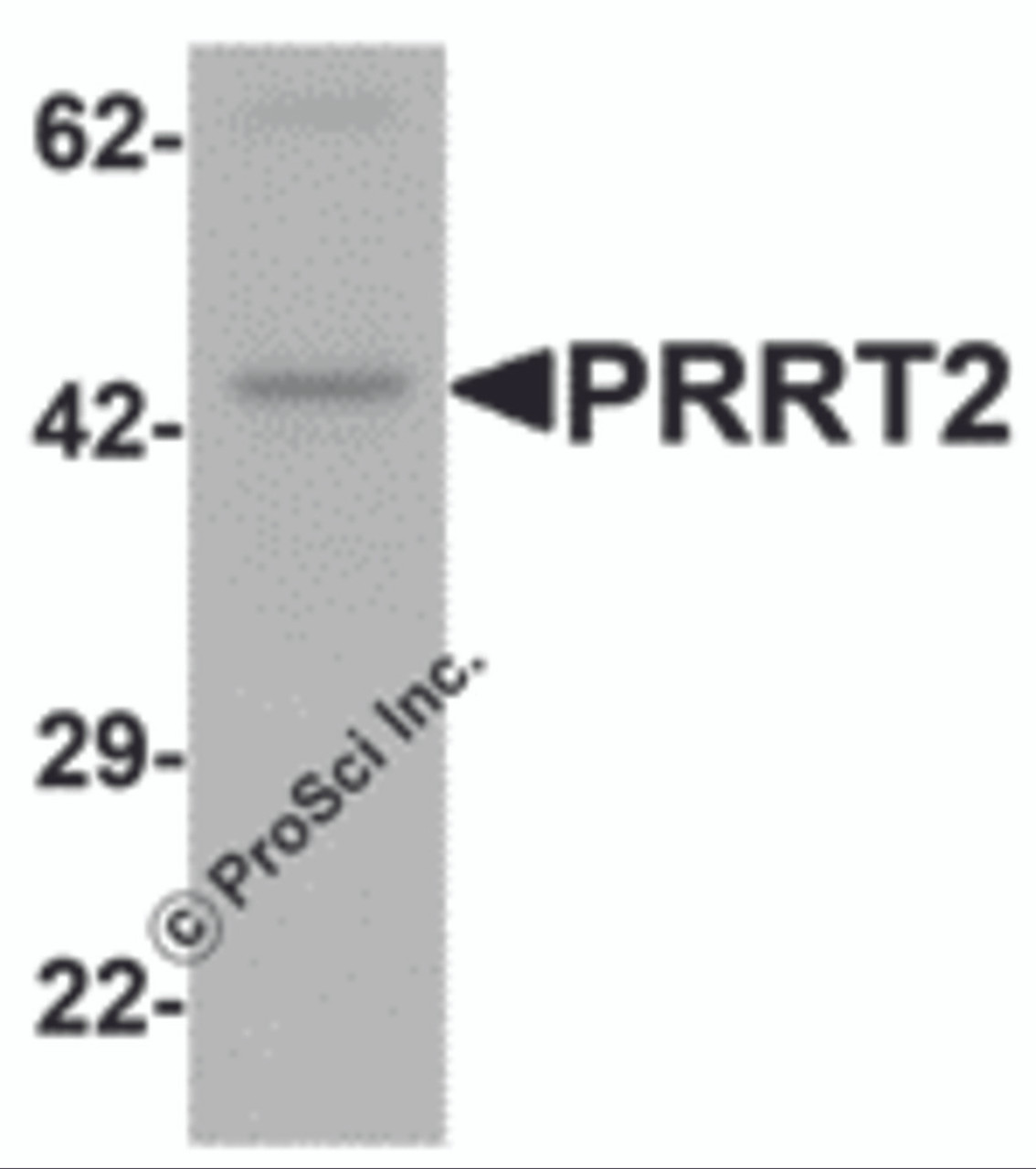 Western blot analysis of PRRT2 in mouse brain tissue lysate with PRRT2 antibody at 1 &#956;g/mL.