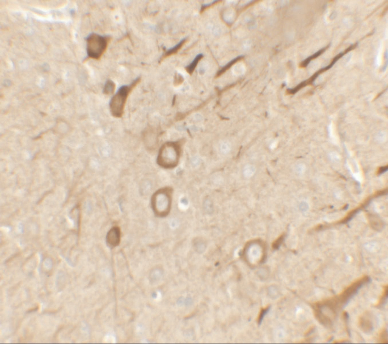 Immunohistochemistry of PRRT2 in rat brain tissue with PRRT2 antibody at 2.5 ug/ml.