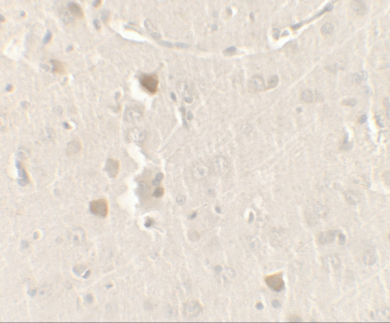 Immunohistochemistry of CISD2 in rat brain tissue with CISD2 antibody at 2.5 ug/ml.