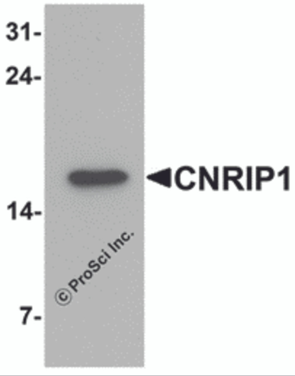 Western blot analysis of CNRIP1 in human brain tissue lysate with CNRIP1 antibody at 1 &#956;g/mL.
