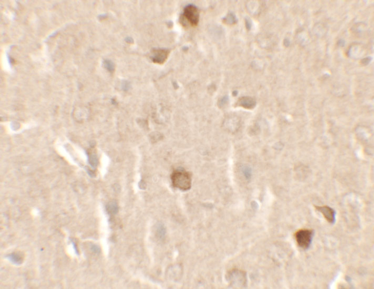 Immunohistochemistry of CNRIP1 in rat brain tissue with CNRIP1 antibody at 2.5 ug/ml.