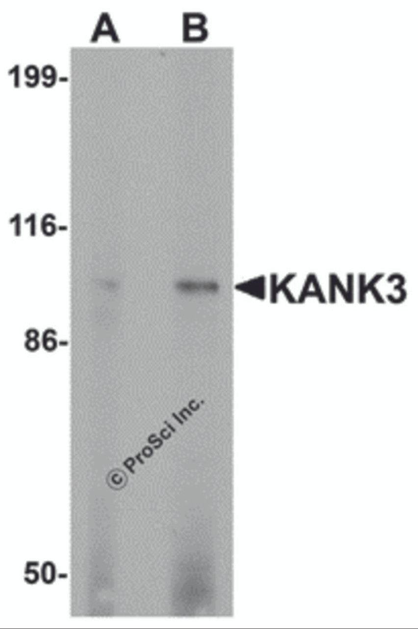 Western blot analysis of KANK3 in A431 cell lysate with KANK3 antibody at (A) 1 and (B) 2 &#956;g/mL.