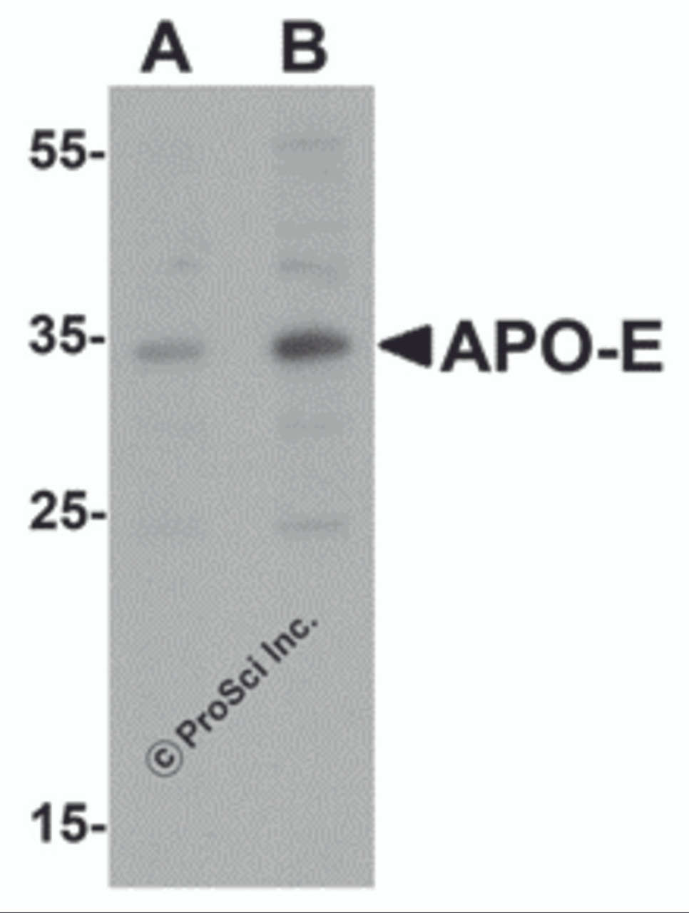 Western blot analysis of APO-E in human brain tissue lysate with APO-E antibody at (A) 0.5 and (B) 1 &#956;g/mL.