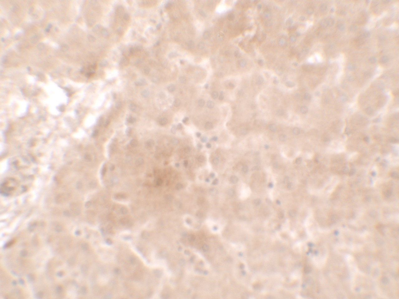 Immunohistochemistry of APO-E inhuman liver tissue with APO-E antibody at 2.5 ug/ml.