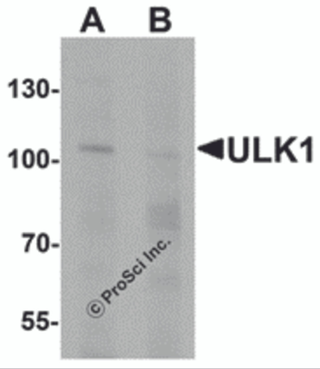 Western blot analysis of ULK1 in rat brain tissue lysate with ULK1 antibody at 1 &#956;g/mL in (A) the absence and (B) the presence of blocking peptide.