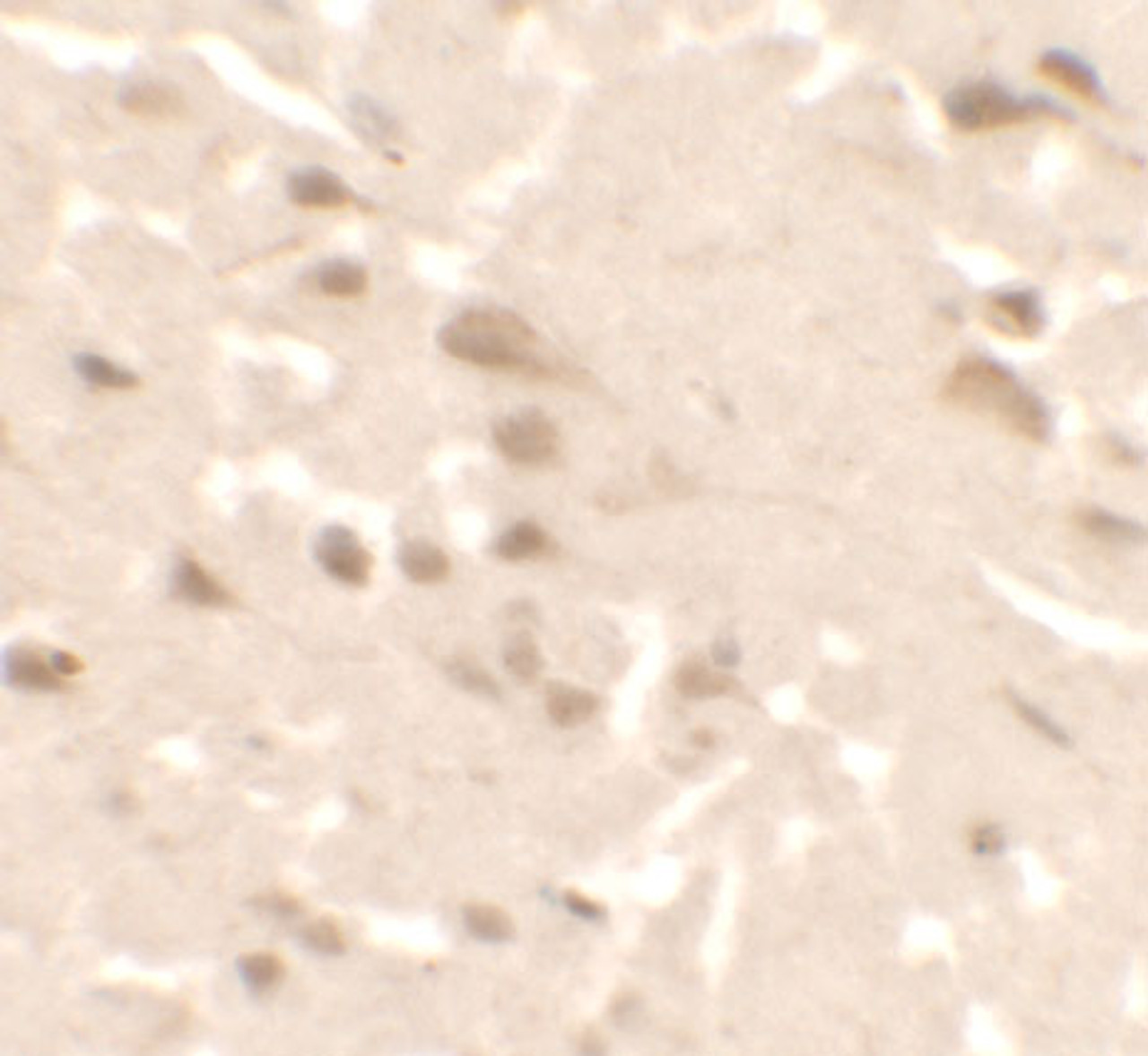 Immunohistochemistry of ULK2 in human brain tissue with ULK2 antibody at 2.5 ug/ml.