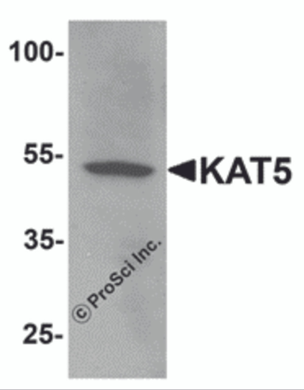 Western blot analysis of KAT5 in human brain tissue lysate with KAT5 antibody at 1 &#956;g/mL.