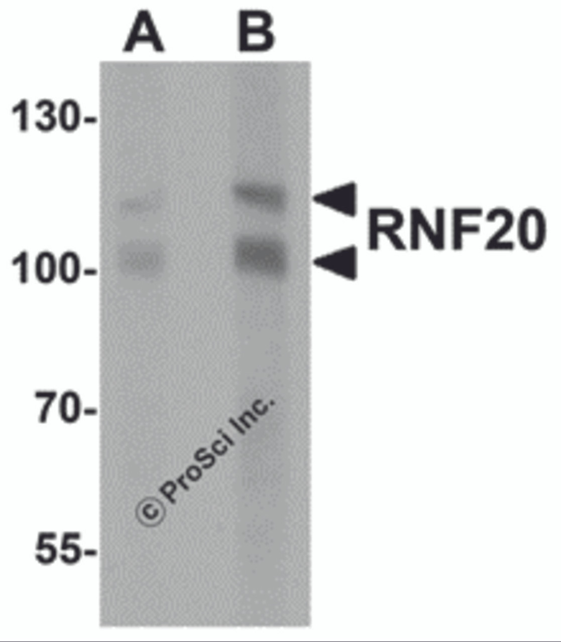 Western blot analysis of RNF20 in human liver tissue lysate with RNF20 antibody at (A) 1 and (B) 2 &#956;g/mL.
