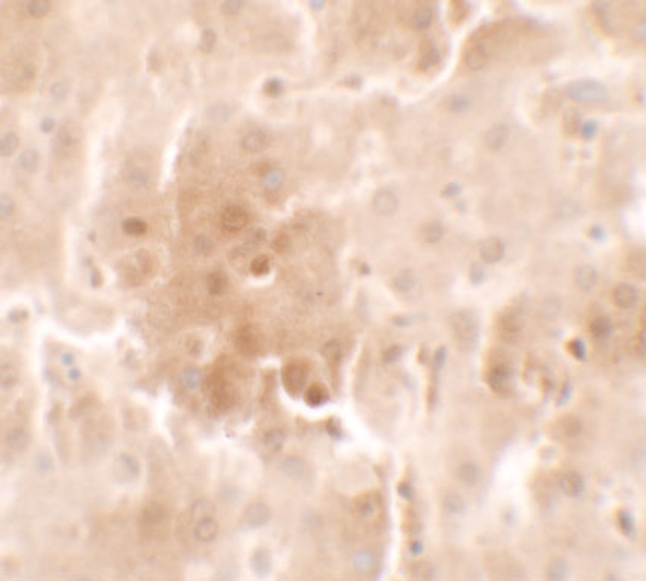 Immunohistochemistry of RNF20 in human liver tissue with RNF20 antibody at 2.5 ug/ml.
