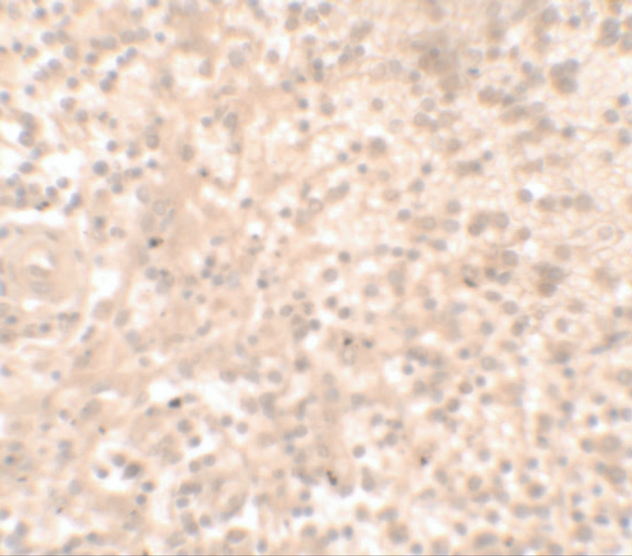 Immunohistochemistry of TLX1 in human spleen tissue with TLX1 antibody at 2.5 ug/ml.