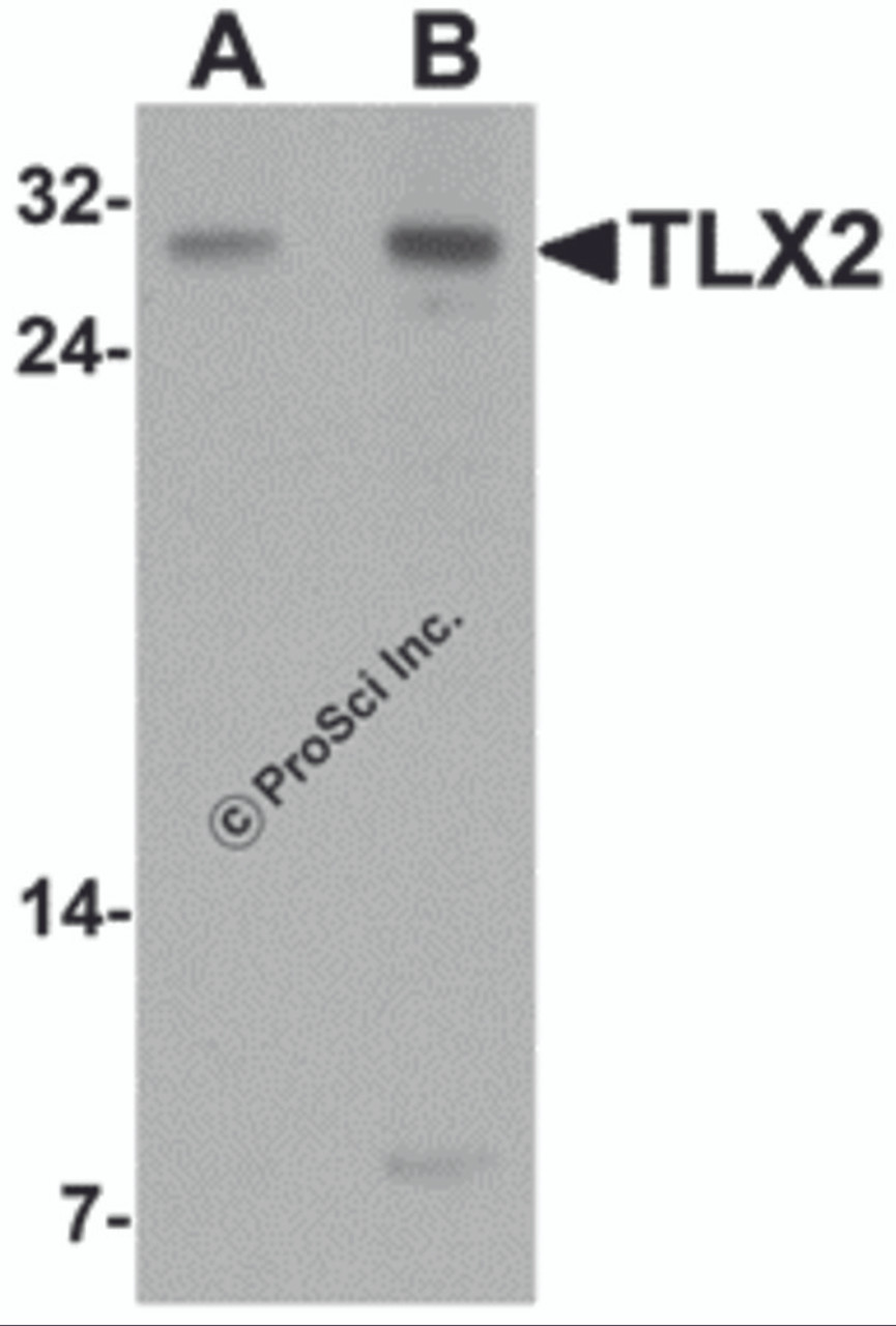 Western blot analysis of TLX2 in rat brain tissue lysate with TLX2 antibody at (A) 0.5 and (B) 1 &#956;g/mL.