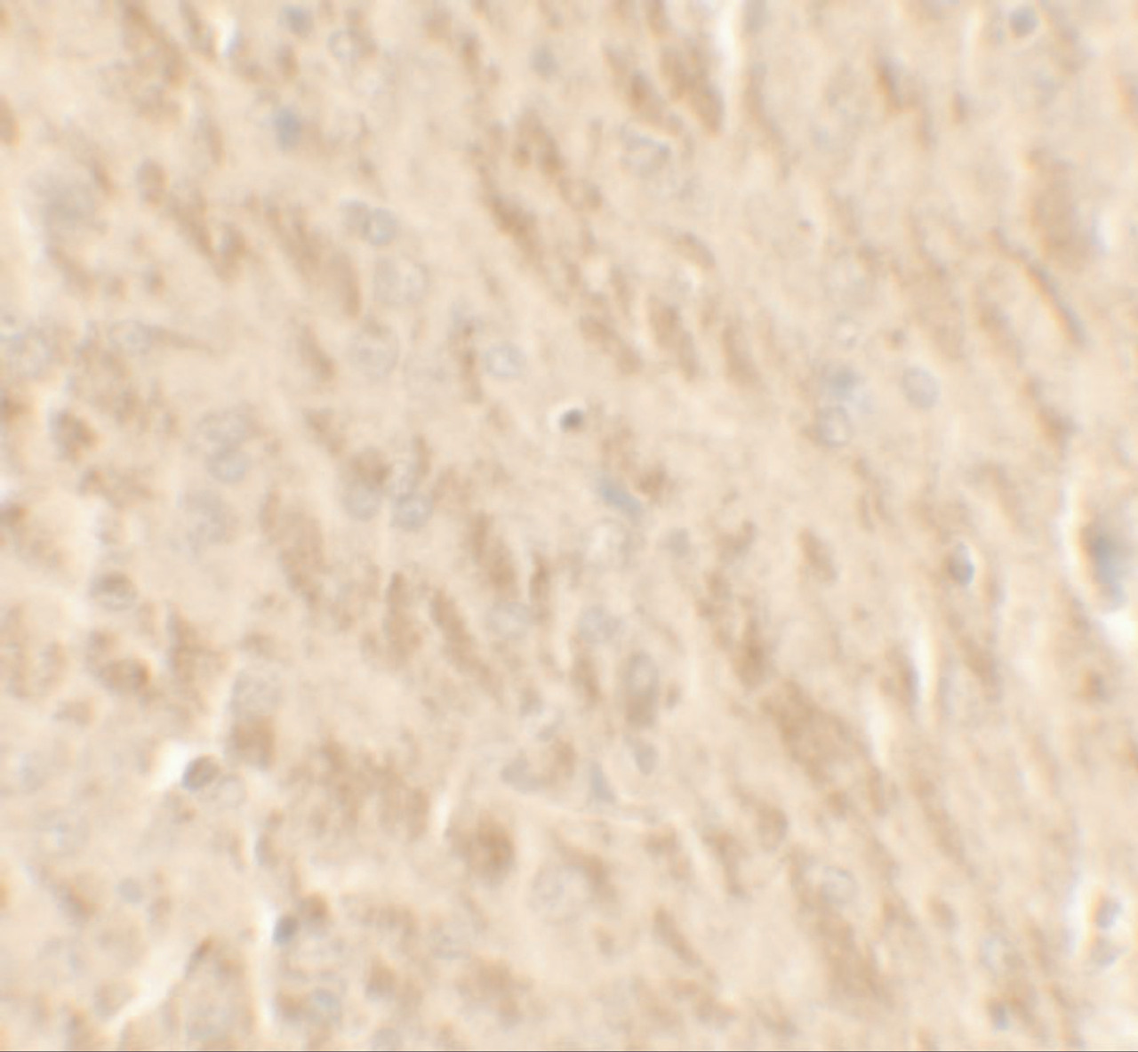 Immunohistochemistry of TLX2 in rat brain tissue with TLX2 antibody at 2.5 ug/ml.