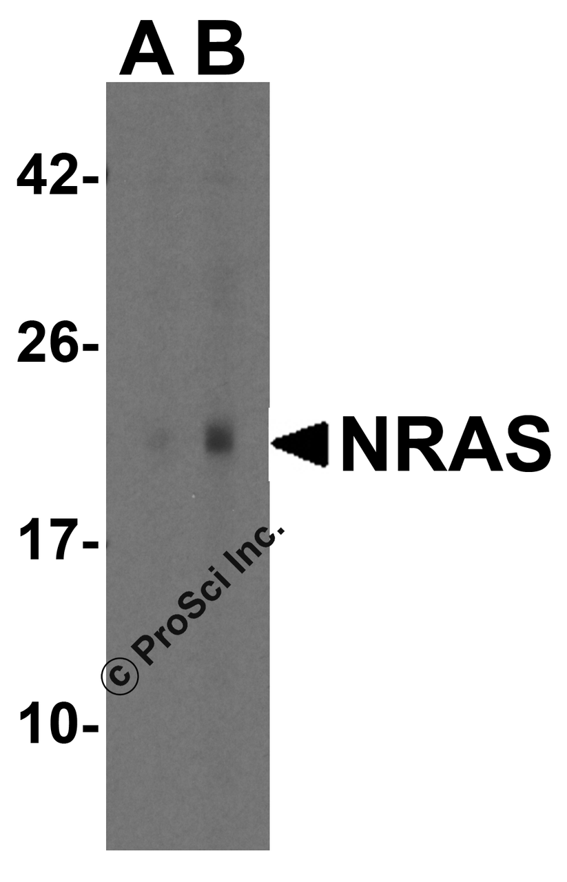Western blot analysis of NRAS in A431 cell lysate with NRAS antibody at (A) 1 and (B) 2 &#956;g/mL.