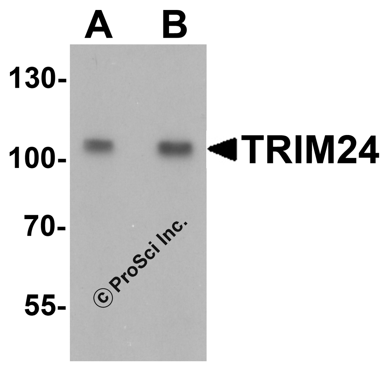 Western blot analysis of TRIM24 in A431 cell lysate with TRIM24 antibody at (A) 0.5 and (B) 1 &#956;g/mL.