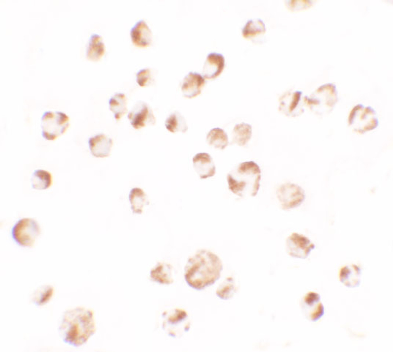 Immunocytochemistry of TRIM24 in EL4 cells with TRIM24 antibody at 2.5 ug/ml.