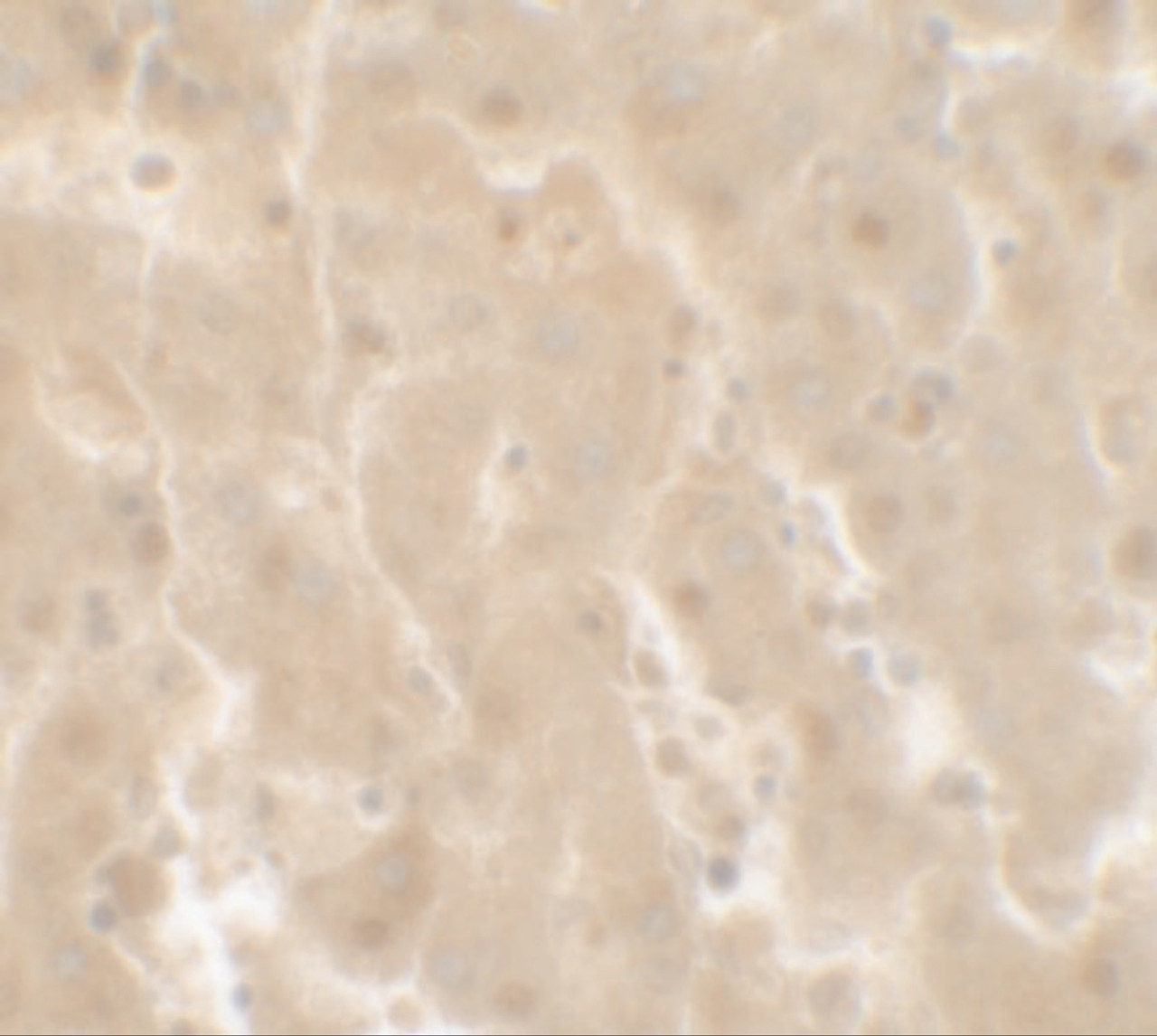 Immunohistochemistry of TRIM33 in human liver tissue with TRIM33 antibody at 2.5 ug/ml.