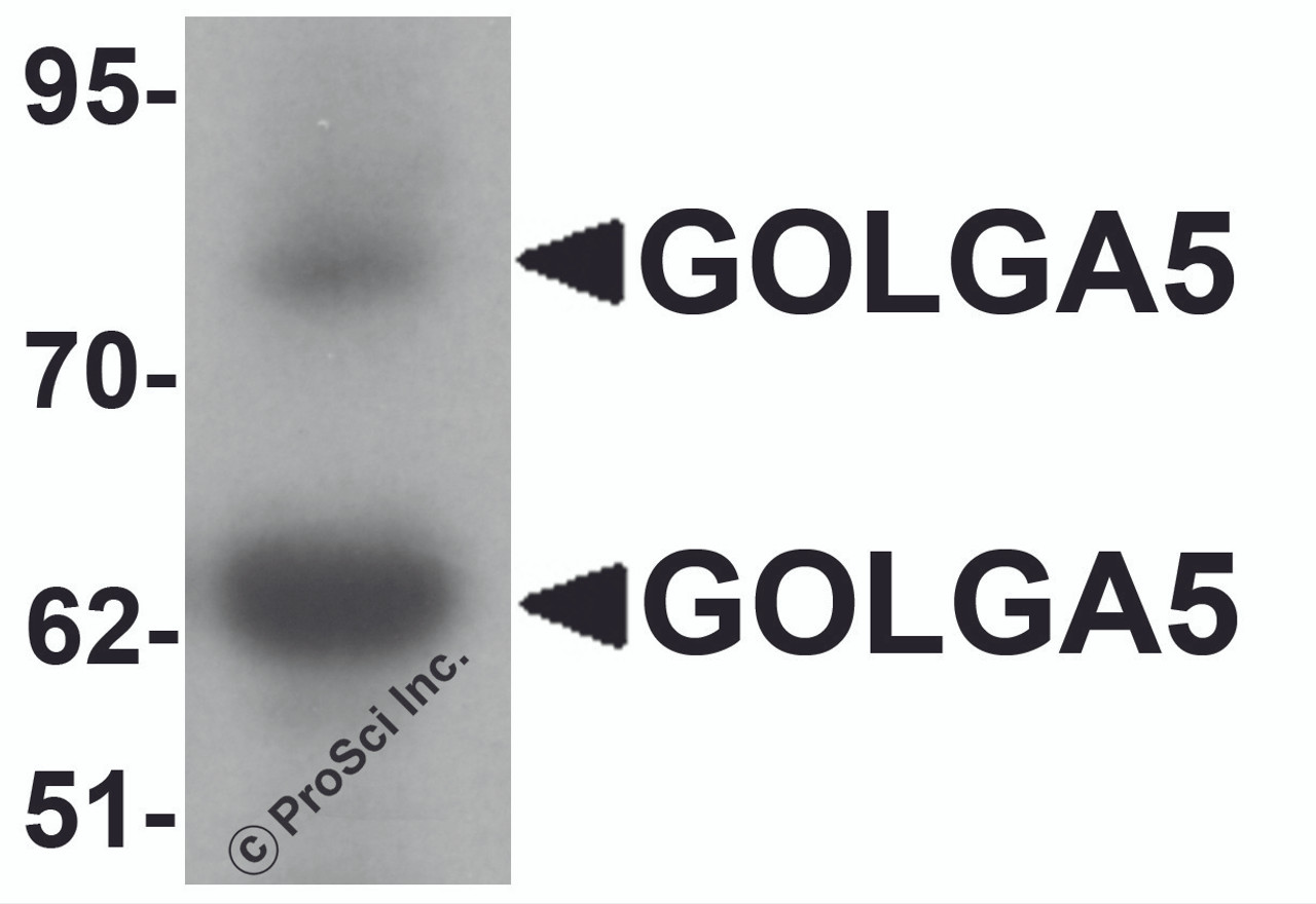 Western blot analysis of GOLGA5 in human testis tissue lysate with GOLGA5 antibody at 1 &#956;g/mL.