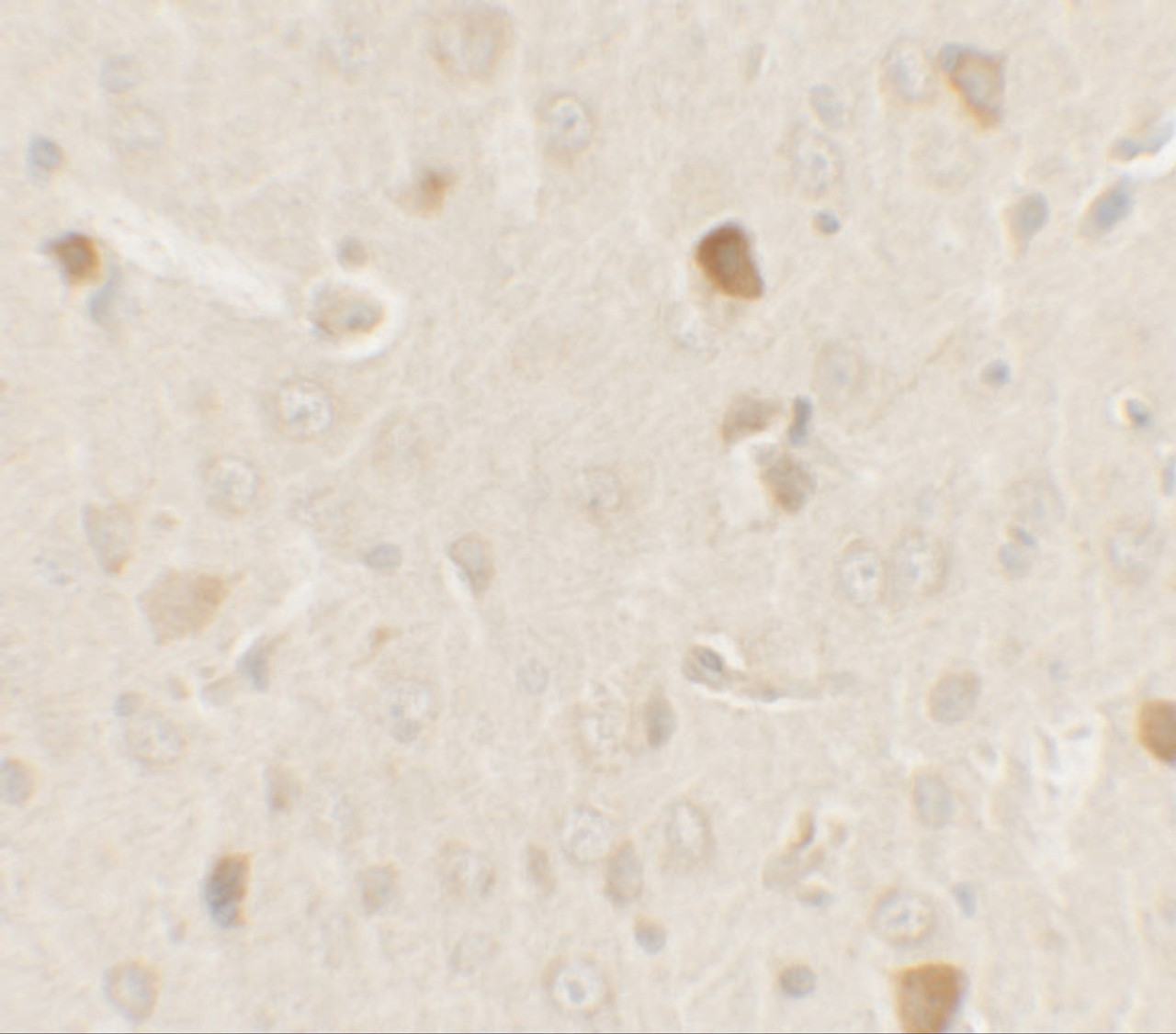 Immunohistochemistry of AKT1S1 in rat brain tissue with AKT1S1 antibody at 2.5 ug/ml.