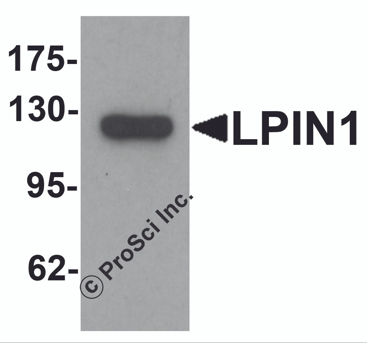 Western blot analysis of LPIN1 in K562 cell lysate with LPIN1 antibody at 1 &#956;g/mL.