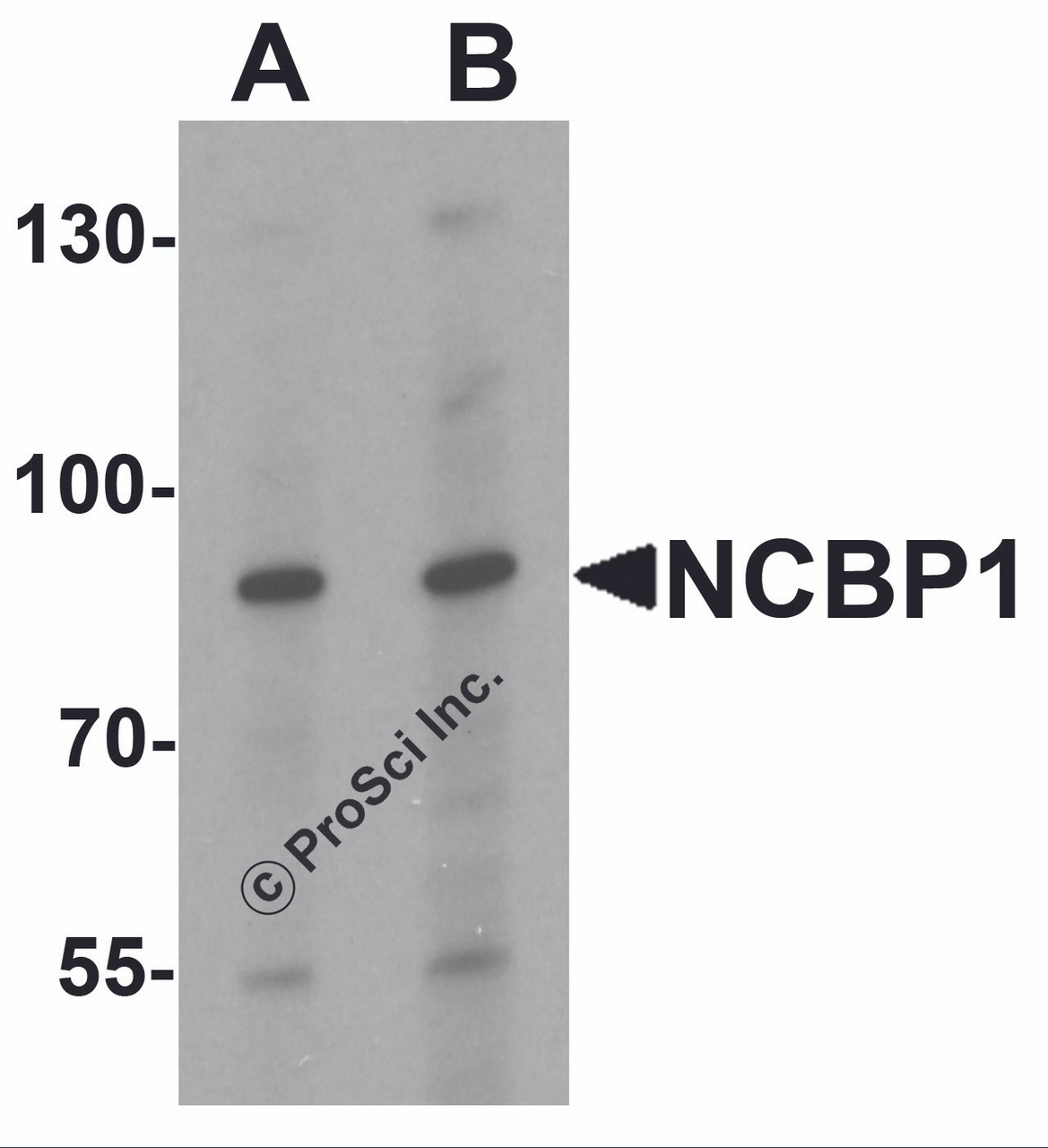 Western blot analysis of NCBP1 in HeLa cell lysate with NCBP1 antibody at (A) 1 and (B) 2 &#956;g/mL.