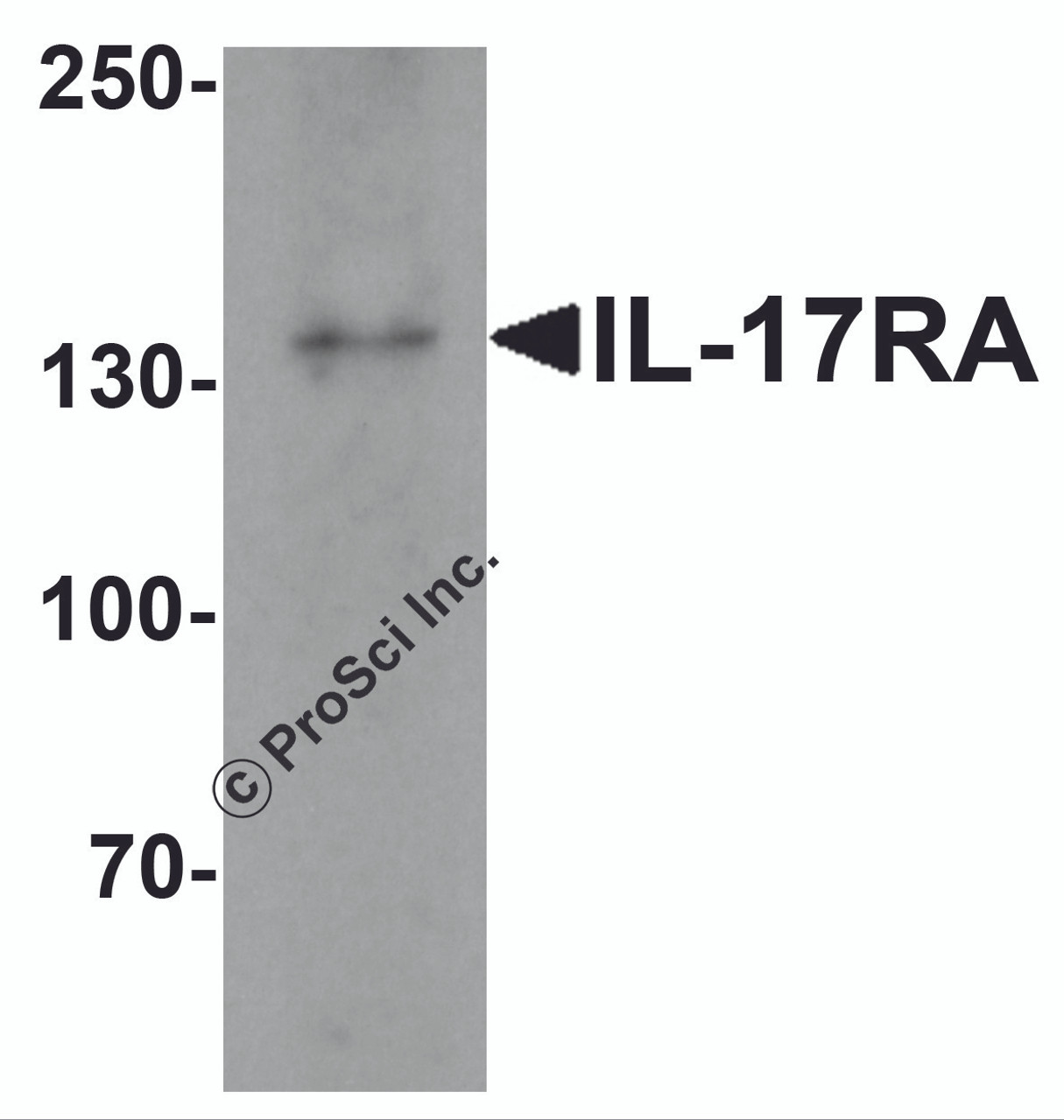 Western blot analysis of IL17RA in A20 cell lysate with IL17RA antibody at 1 &#956;g/mL.
