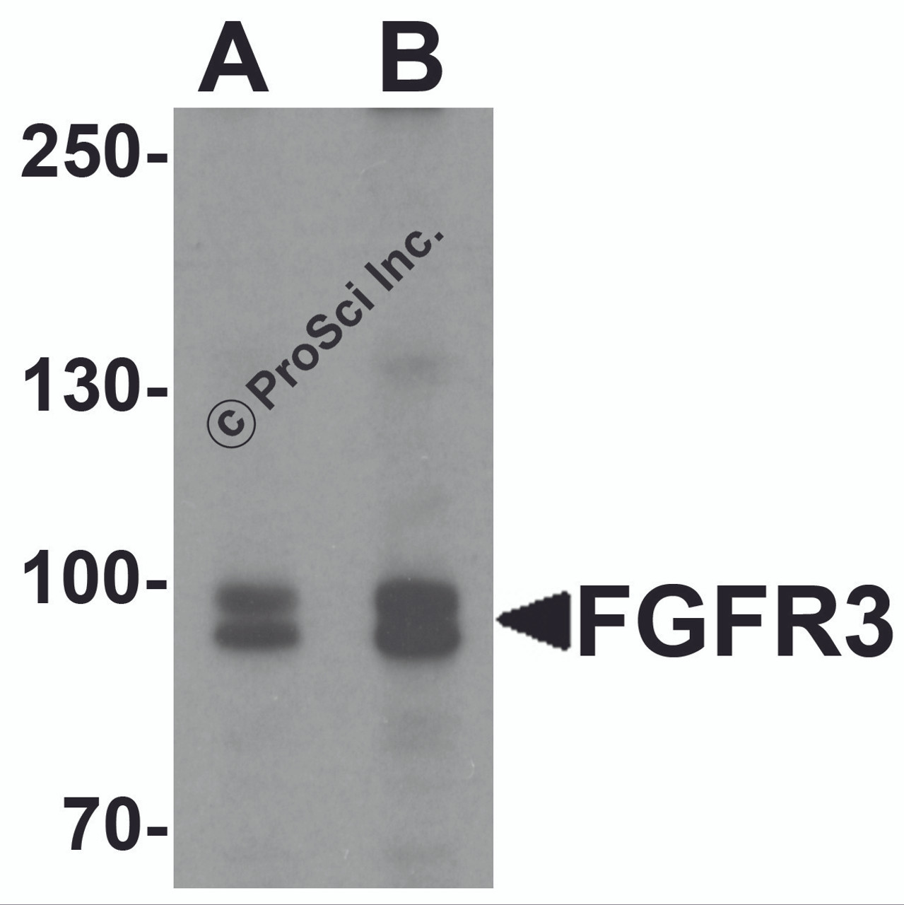 Western blot analysis of FGFR3 in SK-N-SH cell lysate with FGFR3 antibody at (A) 0.5 and (B) 1 &#956;g/mL.