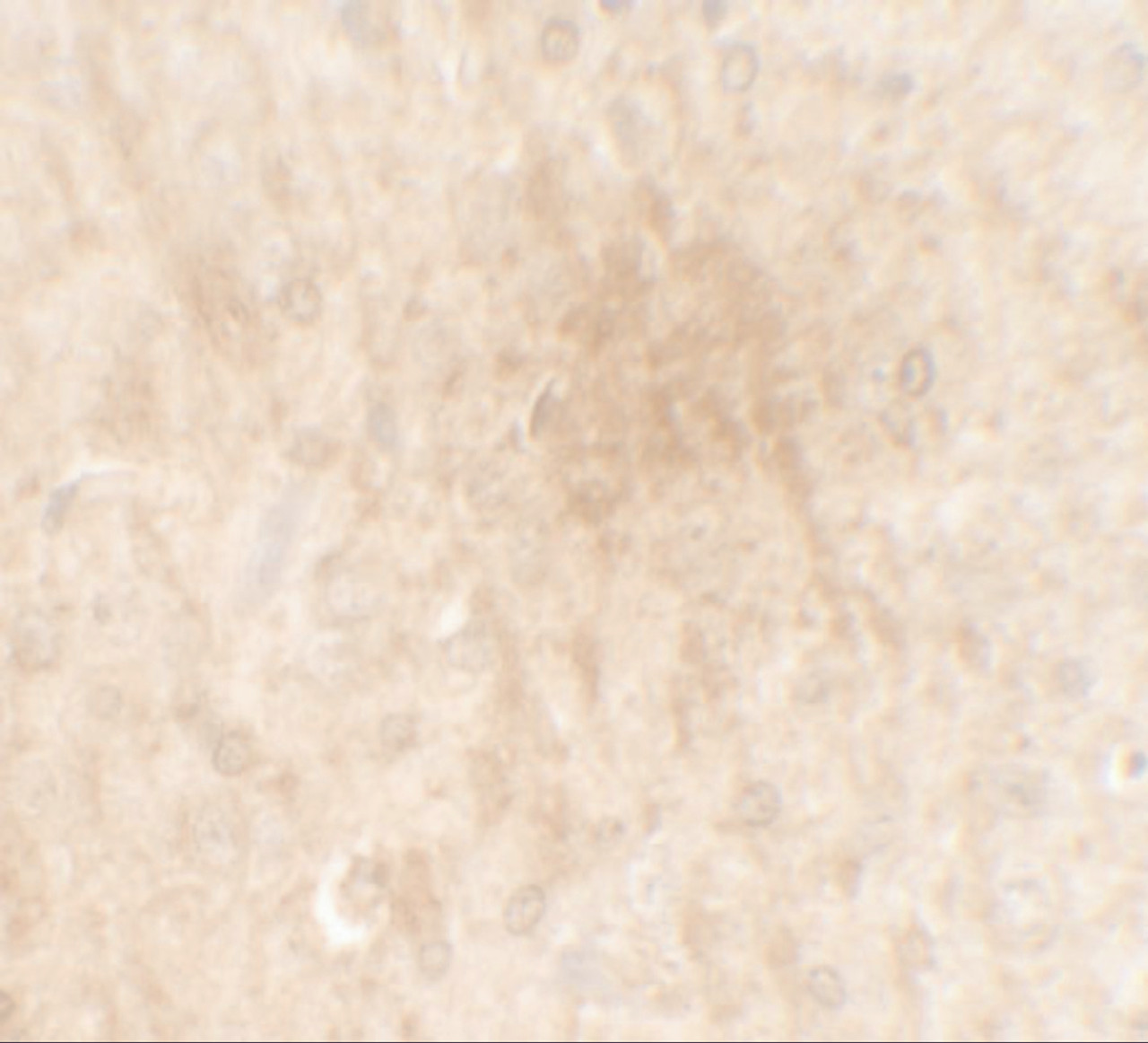 Immunohistochemistry of FGFR3 in rat brain tissue with FGFR3 antibody at 2.5 ug/mL.