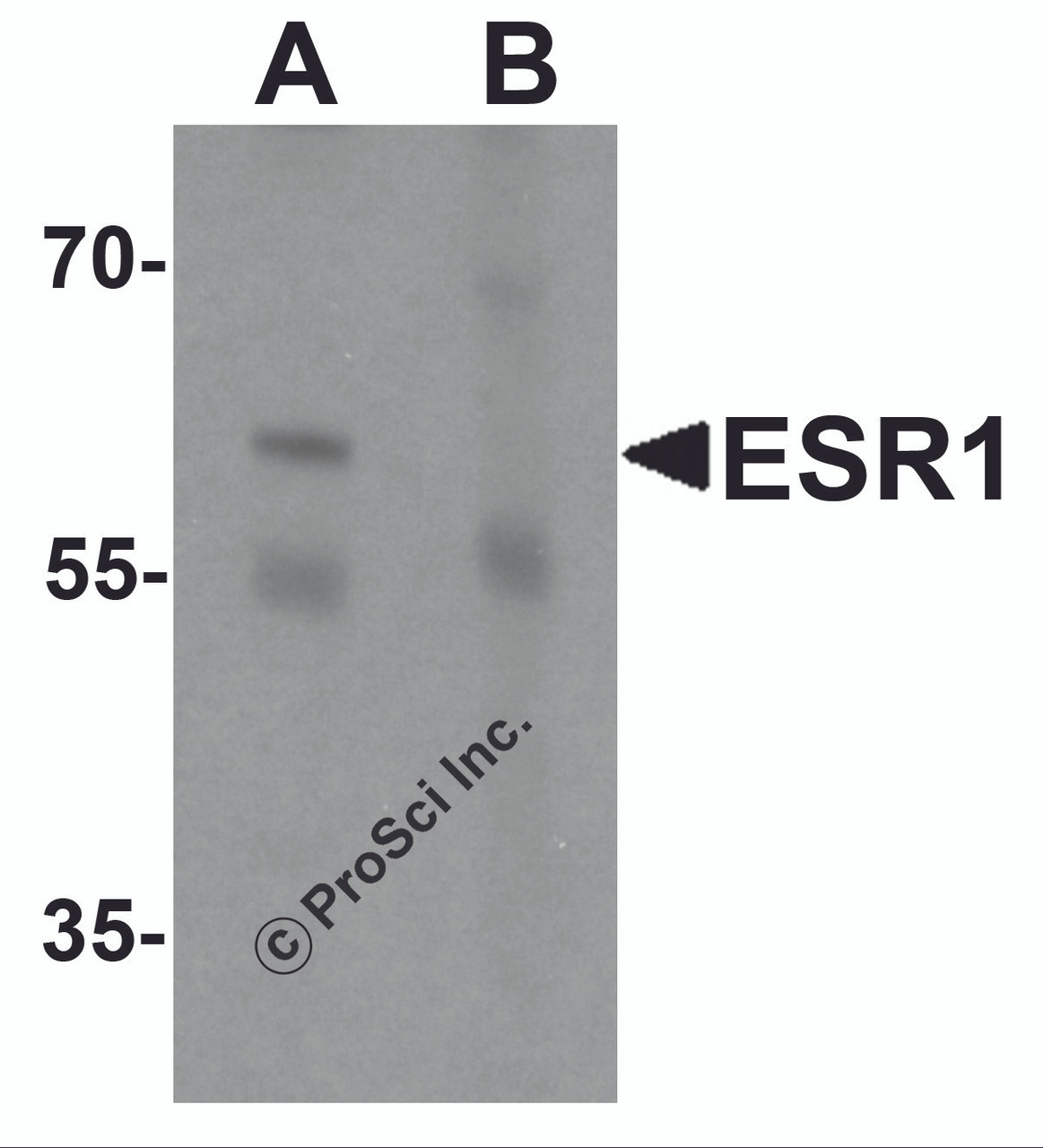 Western blot analysis of ESR1 in rat brain tissue lysate with ESR1 antibody at 1 &#956;g/mL in (A) the absence and (B) the presence of blocking peptide.
