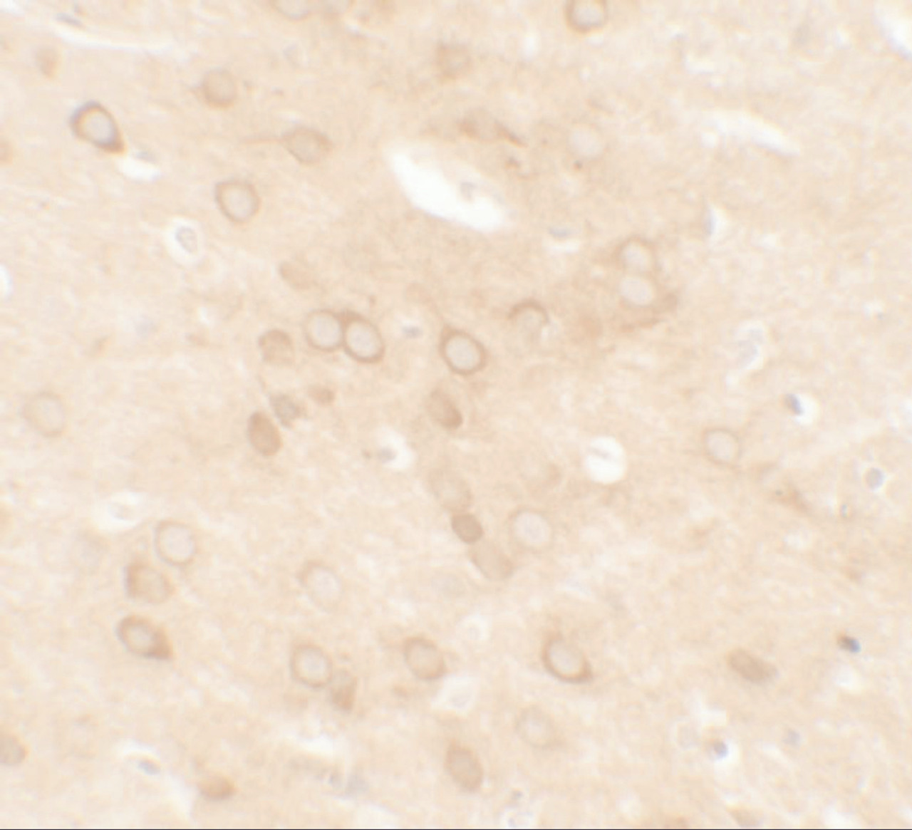 Immunohistochemistry of ESR1 in rat brain tissue with ESR1 antibody at 5 ug/mL.