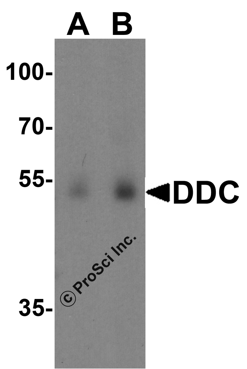 Western blot analysis of DDC in human lung tissue lysate with DDC antibody at (A) 0.5 and (B) 1 &#956;g/ml.