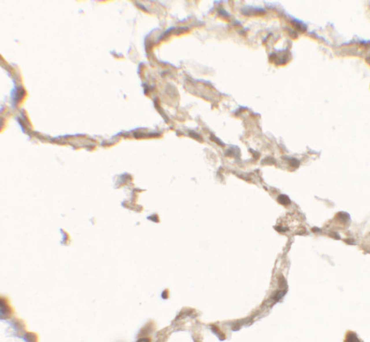 Immunohistochemistry of DDC in human lung tissue with DDC antibody at 2.5 ug/mL.