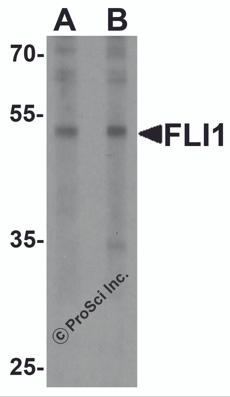 Western blot analysis of FLI1 in Jurkat cell lysate with FLI1 antibody at (A) 0.5 and (B) 1 &#956;g/ml.