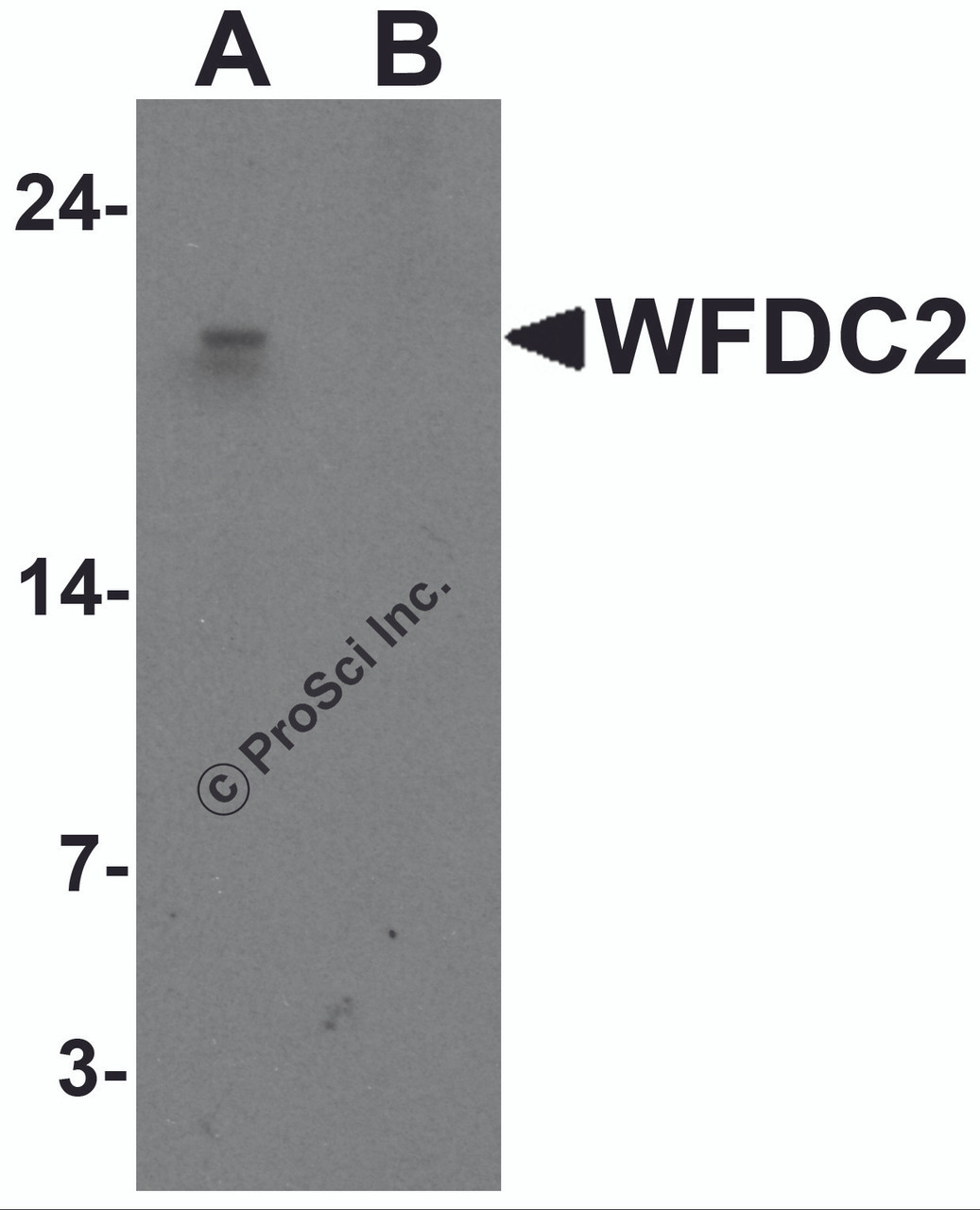 Western blot analysis of WFDC2 in A549 cell lysate with WFDC2 antibody at 1 &#956;g/ml in (A) the absence and (B) the presence of blocking peptide.