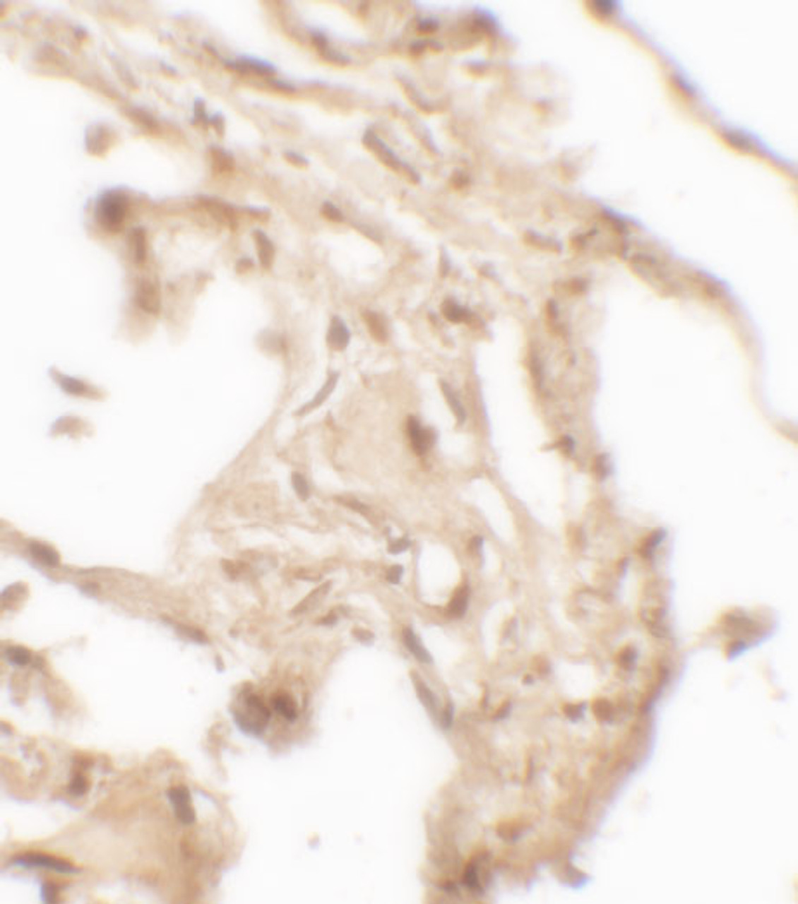 Immunohistochemistry of WFDC2 in human lung tissue with WFDC2 antibody at 2.5 ug/mL.