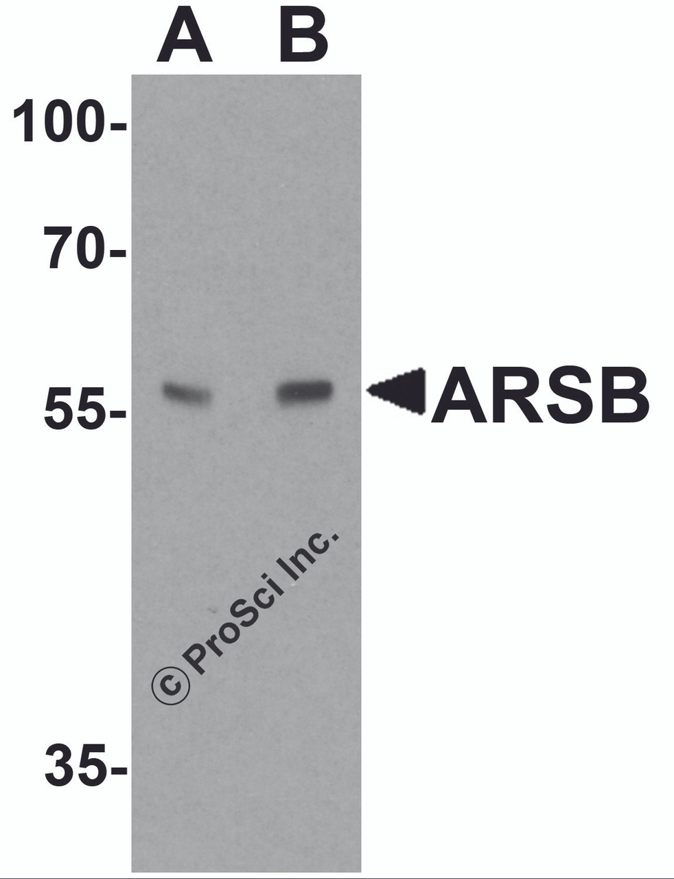 Western blot analysis of ARSB in mouse lung tissue lysate with ARSB antibody at (A) 1 and (B) 2 &#956;g/ml.