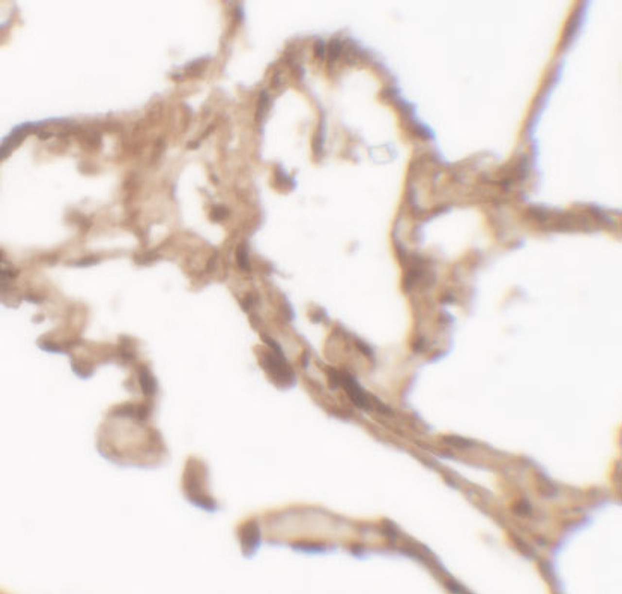 Immunohistochemistry of ARSB in human lung tissue with ARSB antibody at 2.5 ug/mL.