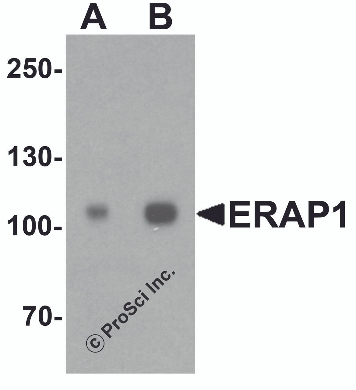 Western blot analysis of ERAP1 in SK-N-SH cell lysate with ERAP1 antibody at (A) 1 and (B) 2 &#956;g/ml.