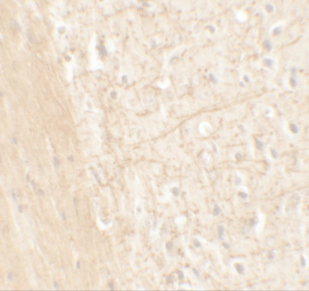 Immunohistochemistry of ERAP1 in mouse brain tissue with ERAP1 antibody at 5 ug/mL.
