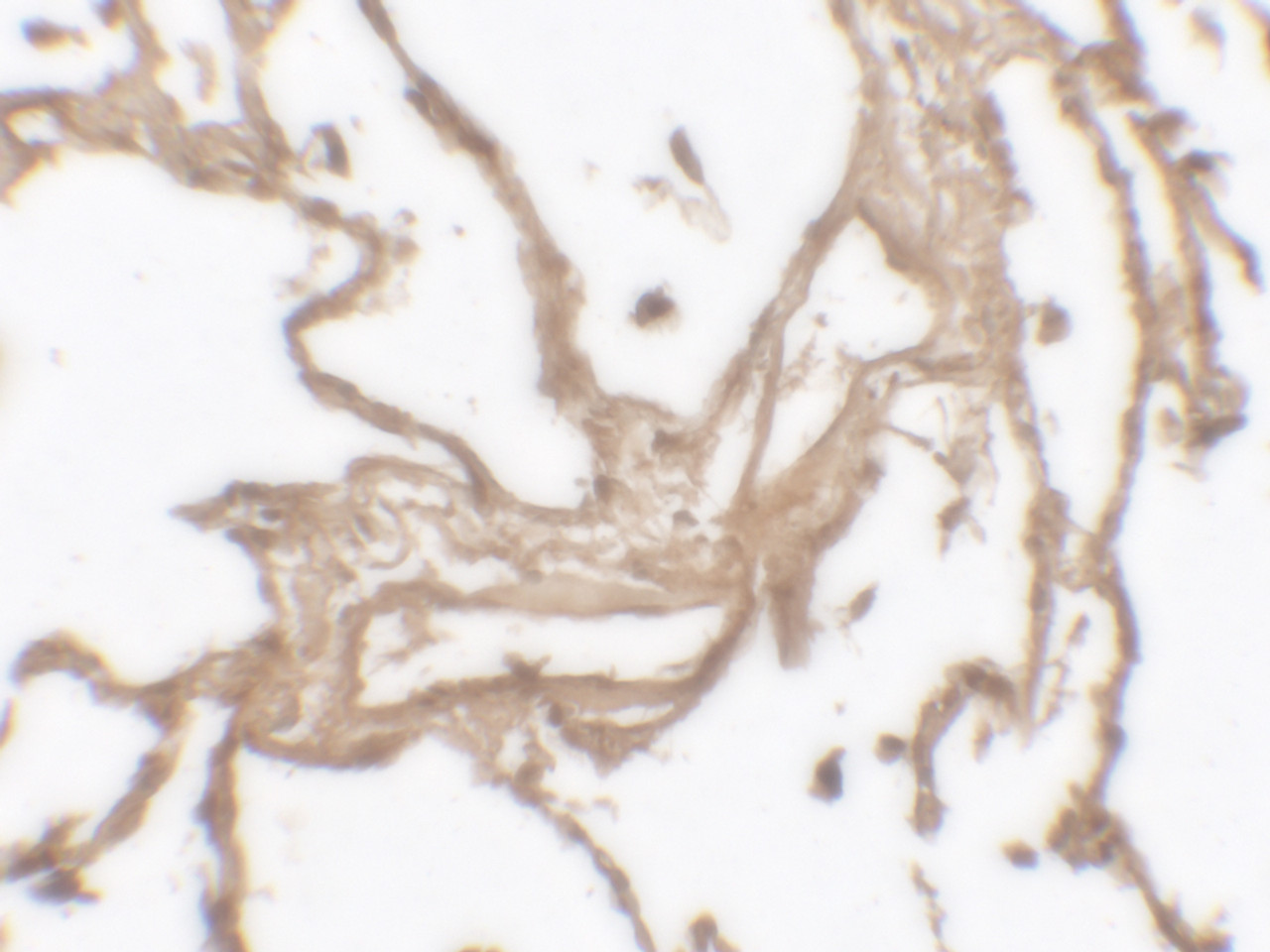 Immunohistochemistry of MMP9 in human lung tissue with MMP9 antibody at 2.5 ug/mL.