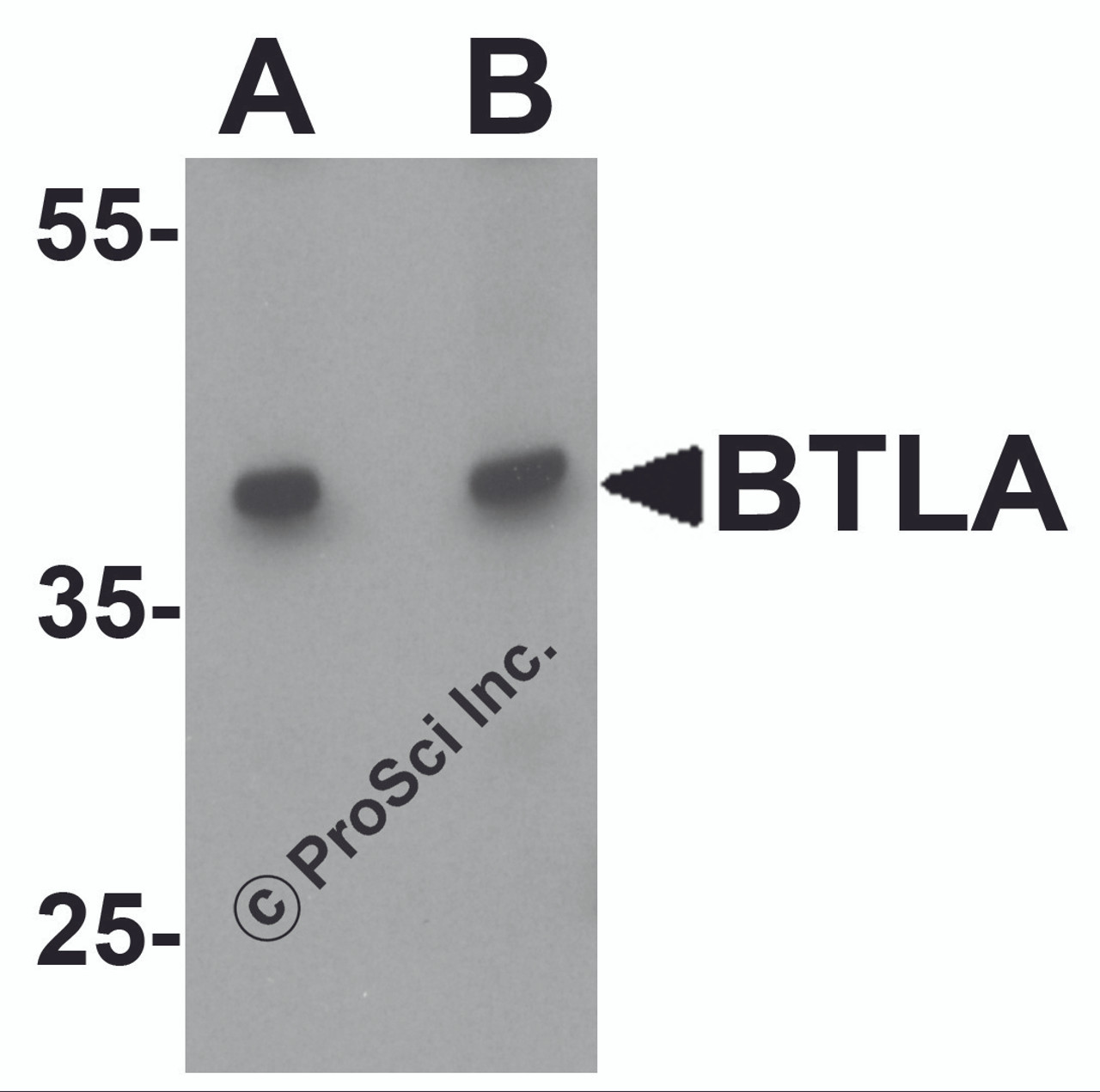 Western blot analysis of BTLA in Jurkat cell lysate at (A) 1 and (B) 2 &#956;g/ml.