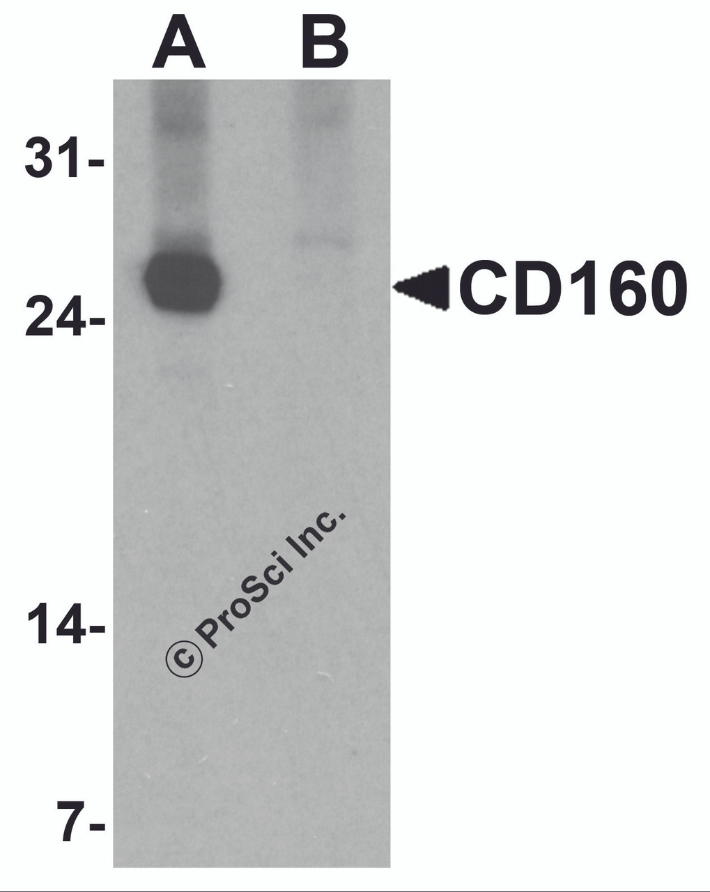 Western blot analysis of CD160 in K562 cell lysate with CD160 antibody at 1 &#956;g/ml in (A) the absence and (B) the presence of blocking peptide.