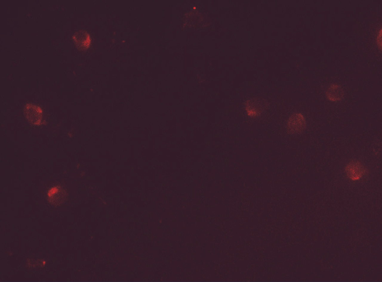 Immunofluorescence of CD160 in Jurkat cells tissue with CD160 antibody at 5 ug/mL.