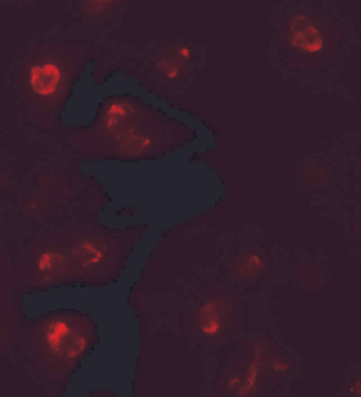 Immunofluorescence of TBX21 in 293 cells with TBX21 antibody at 5 ug/mL.