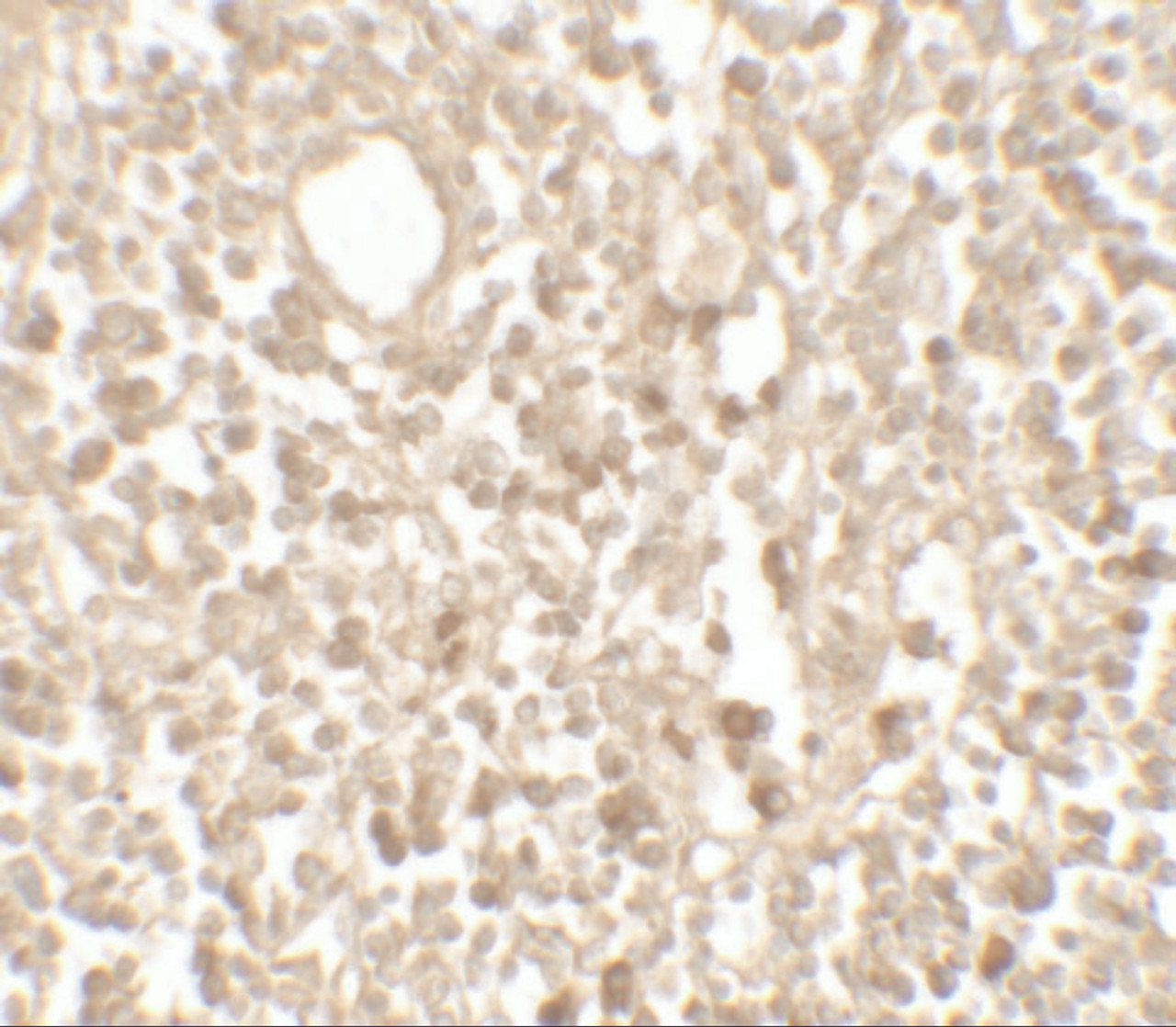 Immunohistochemistry of TMEM107 in human lymph node tissue with TMEM107 antibody at 5 ug/mL.