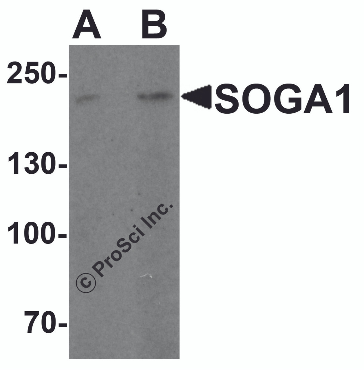Western blot analysis of SOGA1 in Hela cell lysate with SOGA1 antibody at (A) 1 and (B) 2 &#956;g/ml.