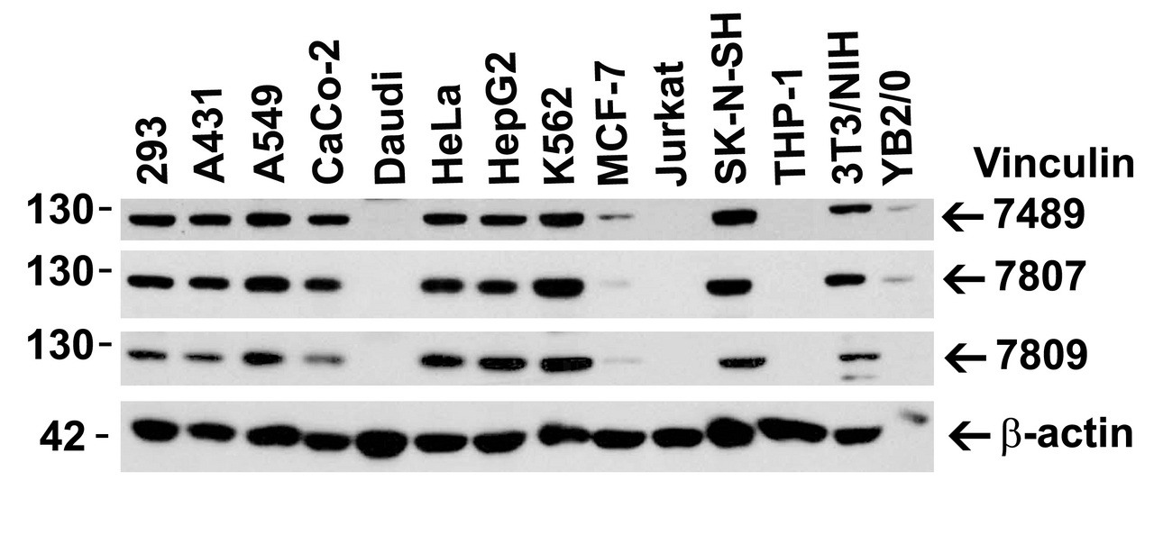 Figure 2 Independent Antibody Validation (IAV) via Protein Expression Profile in Human, Mouse and Rat Cell Lines
Loading: 15 ug of lysates per lane.
Antibodies: Vinculin 7489 (2 ug/mL) , Vinculin 7807 (1 ug/mL) , Vinculin 7809 (1 ug/mL) , and beta-actin 3779 (1.5 ug/mL) , 1h incubation at RT in 5% NFDM/TBST.
Secondary: Goat anti-rabbit IgG HRP conjugate at 1:10000 dilution.
