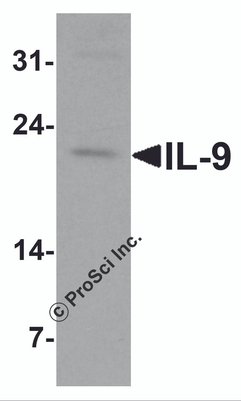 Figure 1 Western Blot Validation in Human Spleen Tissue Lysate
Loading: 15 &#956;g of lysates per lane.
Antibodies: IL-9, 7495 (1 &#956;g/mL) , 1h incubation at RT in 5% NFDM/TBST.
Secondary: Goat anti-rabbit IgG HRP conjugate at 1:10000 dilution.