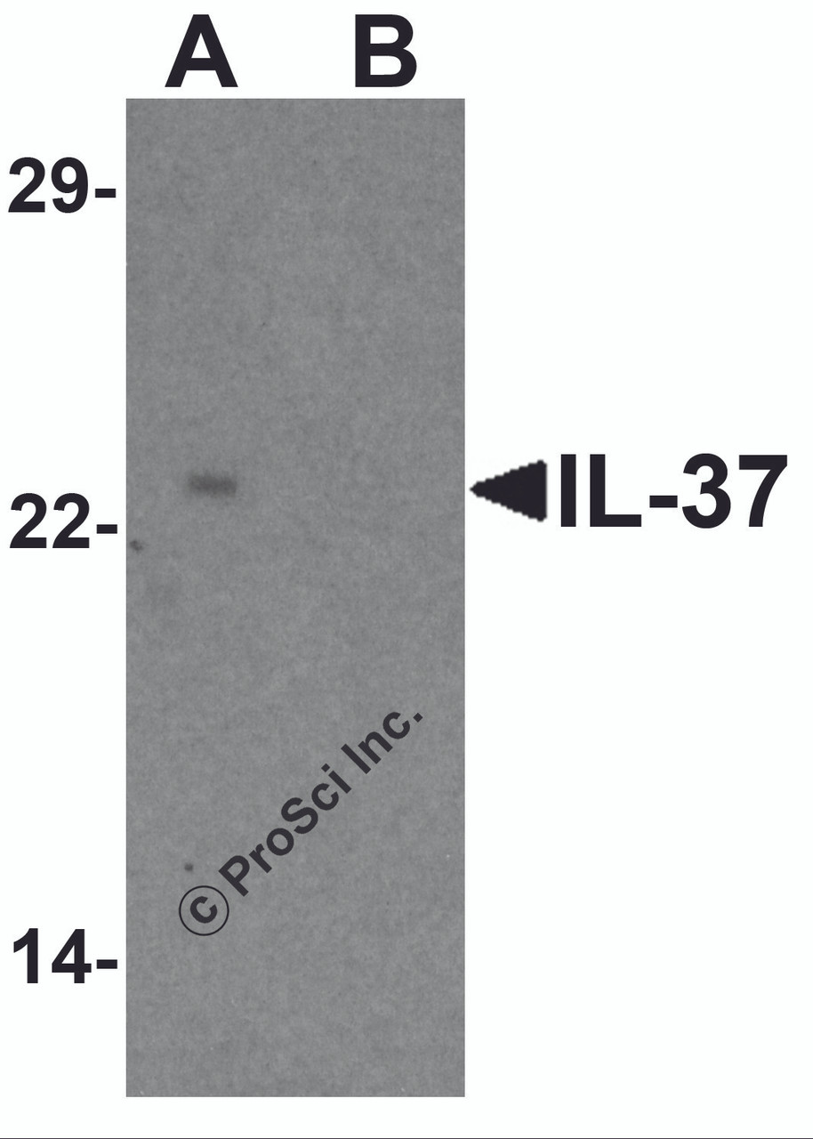 Western blot analysis of IL-37 in human lung tissue lysate with IL-37 antibody at 1 &#956;g/ml in (A) the presence and (B) the absence of blocking peptide.