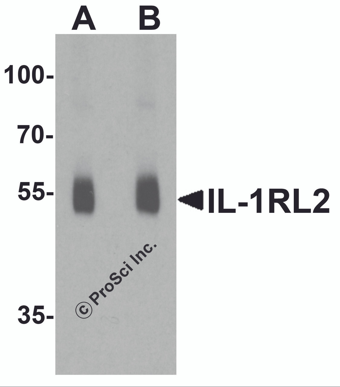 Western blot analysis of IL-1RL2 in human small intestine lysate with IL-1RL2 antibody at (A) 1 and (B) 2 &#956;g/ml.