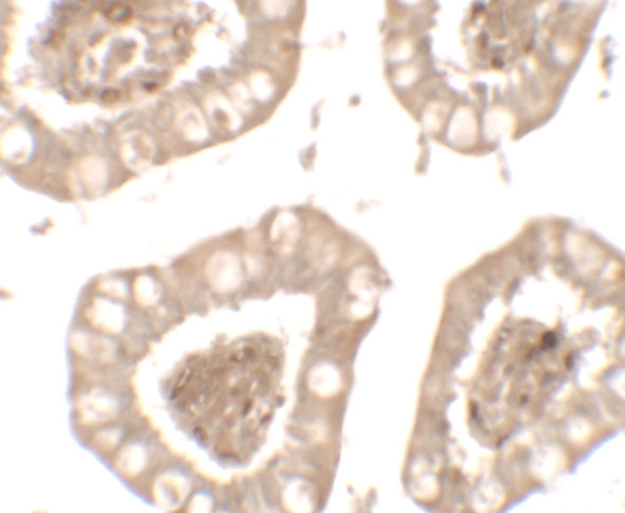 Immunohistochemistry of IL-1RL2 in human small intestine tissue with IL-1RL2 antibody at 5 ug/mL.